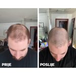 Yasenka Skinage SPRAY LOSION ZA RAST KOSE 125ml - Image 5