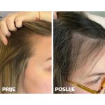 Yasenka Skinage SPRAY LOSION ZA RAST KOSE 125ml - Image 6